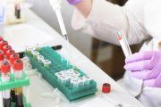 Les dades d’aquest estudi podrien obrir la porta a noves estratègies preventives i de tractament.
