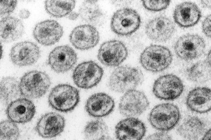 El projecte en el que col.labora l'Anna Rull (IISPV) investiga els mecanismes que permeten a un petit grup de pacients controlar el VIH sense tractament