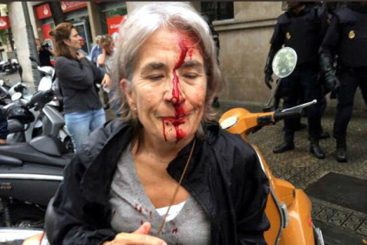 La cara ensangrentada de una mujer ante|delante de la Escuela Niño Jesús de Barcelona, después de una carga policial.