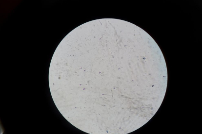 Esperma humano bajo el microscopio.