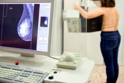 Una dona es fa una mamografia per detectar si té càncer de mama.
