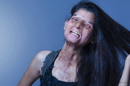 Imatge de la campanya de Stop Acid Attacks.