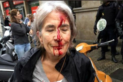 Una dona ferida davant l'Escola Infant Jesús de Barcelona, després d'una càrrega policial l'1 d'octubre del 2017.