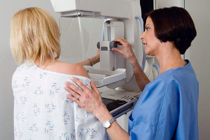 Imatge d'arxiu d'una mamografia.