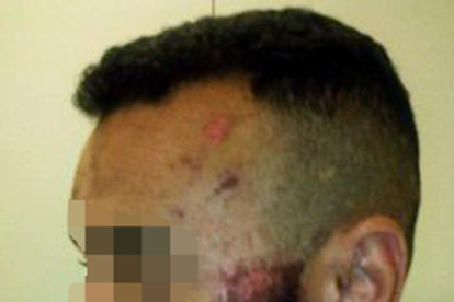 Pla sencer del cap de l'home amb diverses ferides a la cara. Imatge publicada el 23 de setembre del 2019