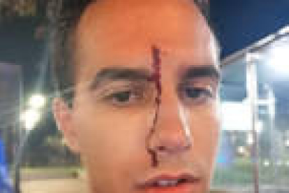 El periodista del Canal Blau Xavi Martínez con una herida sangrando en la frente después de haber sufrido una agresión homófoba.