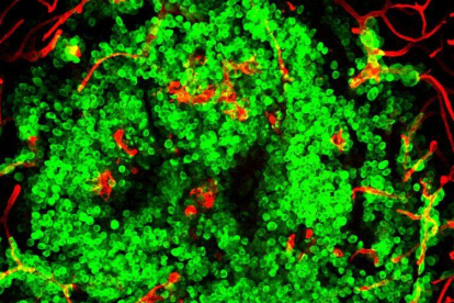 Células tumorales (en verde) invadiendo un cerebro de ratón, con los vasos sanguíneos en color rojo. /CNIO