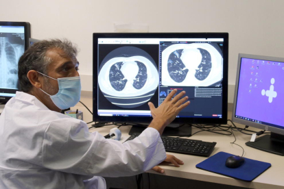 Manel Escobar ensenyant la nova eina d'anàlisi de TAC pulmonars