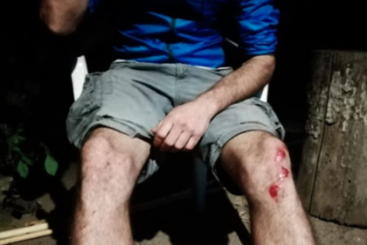 Heridas en las piernas del joven de Riudecanyes.