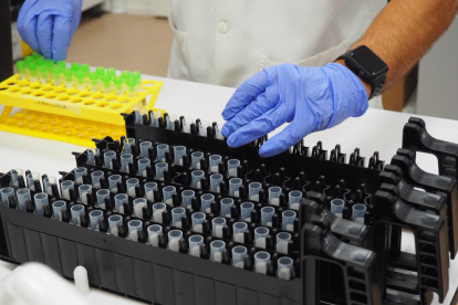 Varias muestras PCR a punto para entrar en la nueva máquina que permite procesar más rápidamente en el laboratorio del ICS Girona.