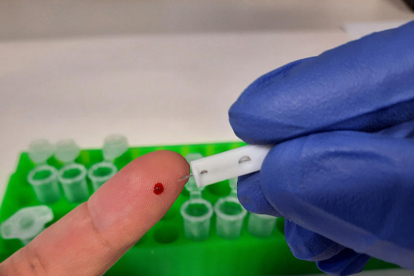 El test només necessita una gota de sang per a analitzar la mostra en tan sols 24 hores.