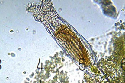 Imatge d'un organisme del gènere bdelloidea.