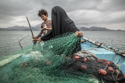 Fotografía de Pablo Tosco 'Yemen: Hunger, Another War Wound'.