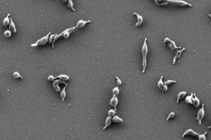 Imagen de microscopia electrónica de células de 'Mycoplasma genitalium'.
