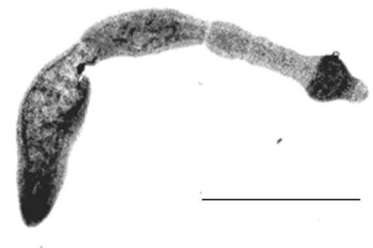Imatge d'una tènia de l'espècie Echinococcus multilocularis.