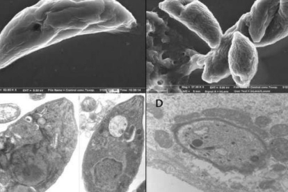 Imágenes de parásitos de Toxoplasma.