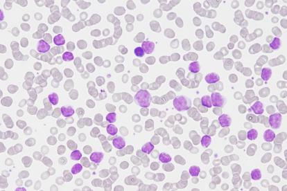 Imatge d'una citologia sanguínia.