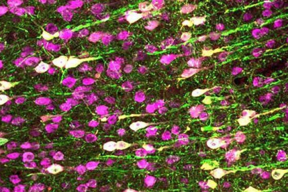 Las neuronas en blanco se han podido activar gracias a los ultrasonidos.