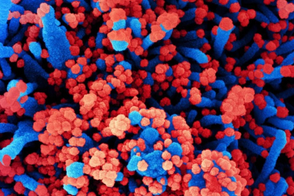 Micrografía electrónica de barrido de células humanas (azul) infectadas con SARS-CoV-2 (rojo).