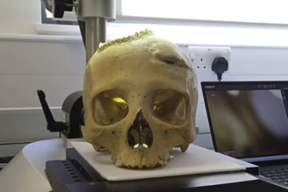 Los cráneos se examinaron mediante análisis microscópico y tomografía computarizada.