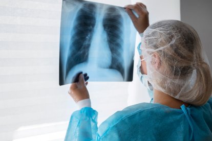 Imatge d'una metge mirant una radiografia dels pulmons.