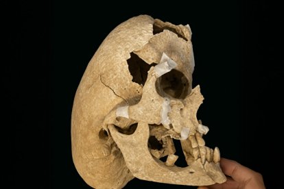 Reconstrucció cranial.