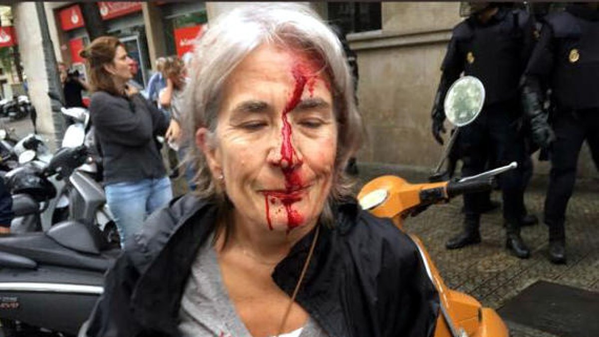 Una dona amb la cara ensangonada davant l'Escola Infant Jesús de Barcelona, després d'una càrrega policial de l'1 d'octubre.