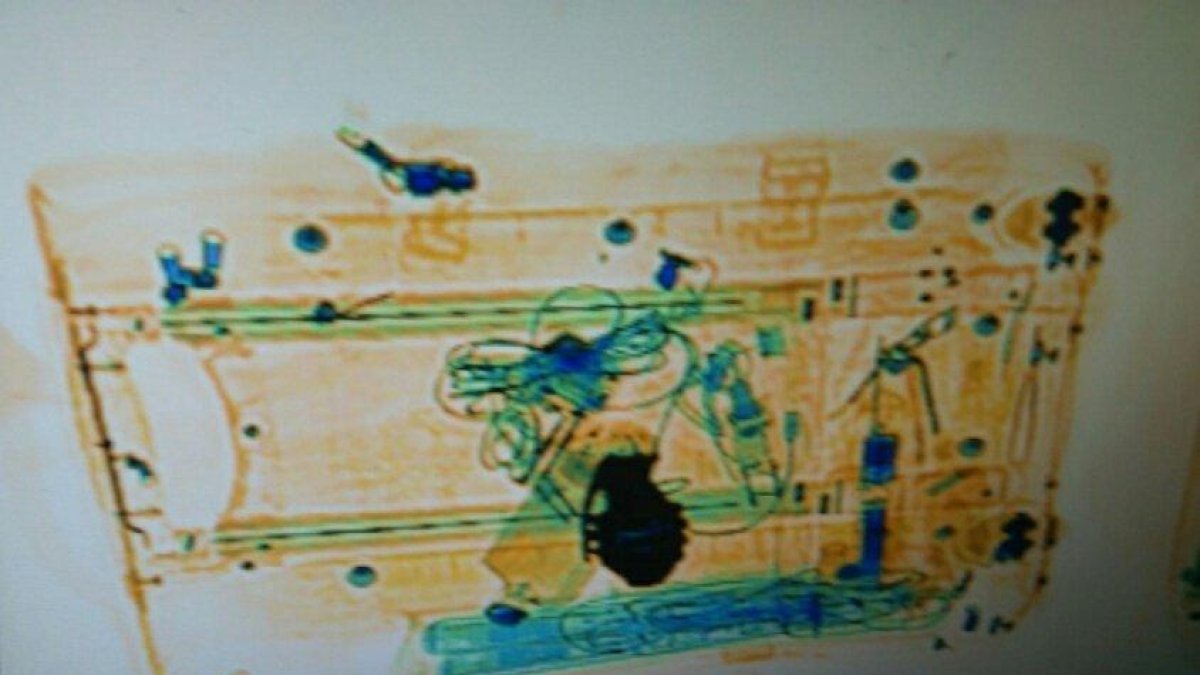 Esta es la imagen de escáner donde se puede ver el objeto sospechoso.