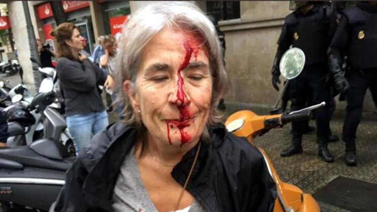 Una mujer herida ante la Escuela Nen Jesús de Barcelona, después de una carga policial el 1 de octubre del 2017.