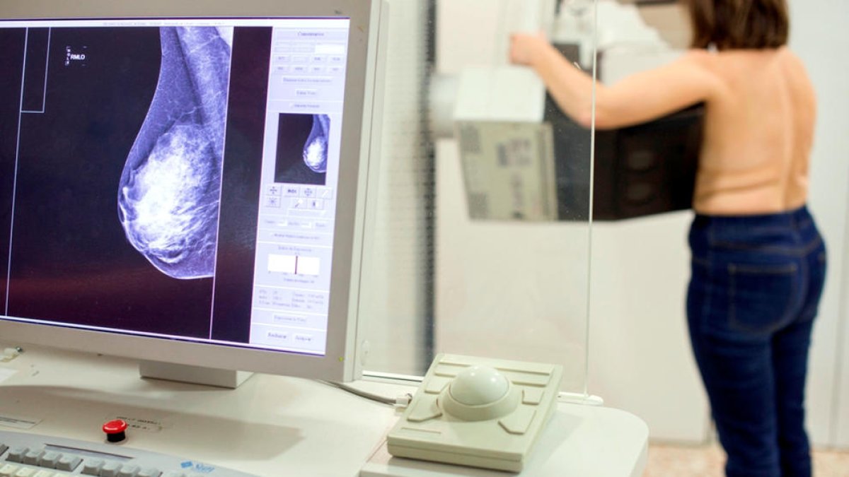 Una mujer se hace una mamografía por detectar si tiene cáncer de mama.