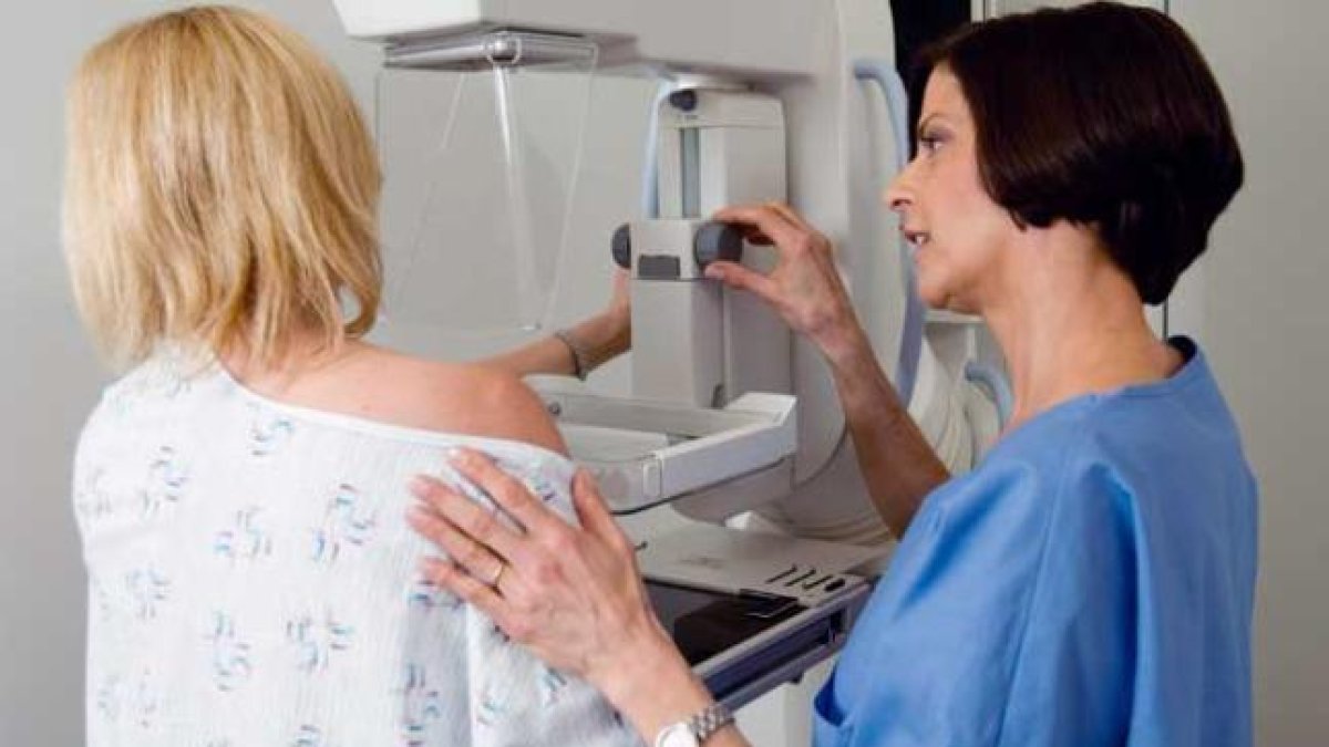 Imatge d'arxiu d'una mamografia