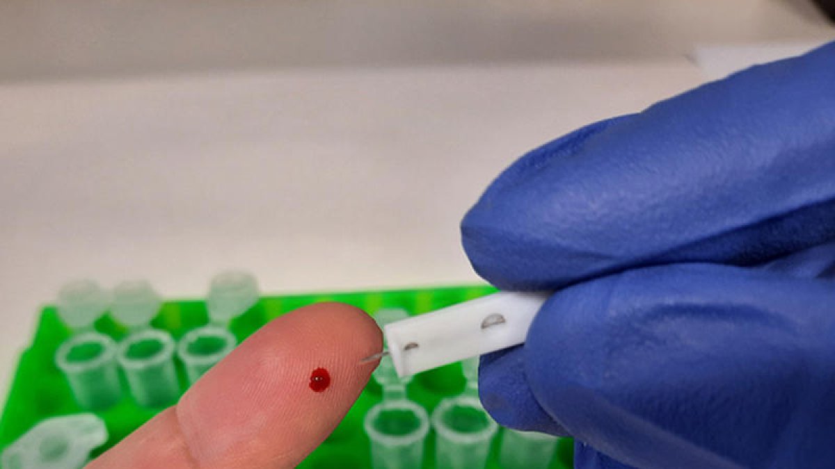 El test solo necesita una gota de sangre para analizar la muestra en tan solo 24 horas.