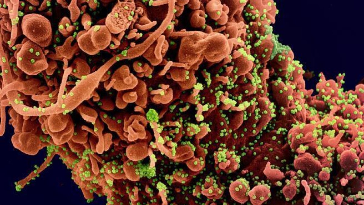 Imagen que muestra una célula infectada por coronavirus. El Covid-19 se ha coloreado en verde para que sea más visible.