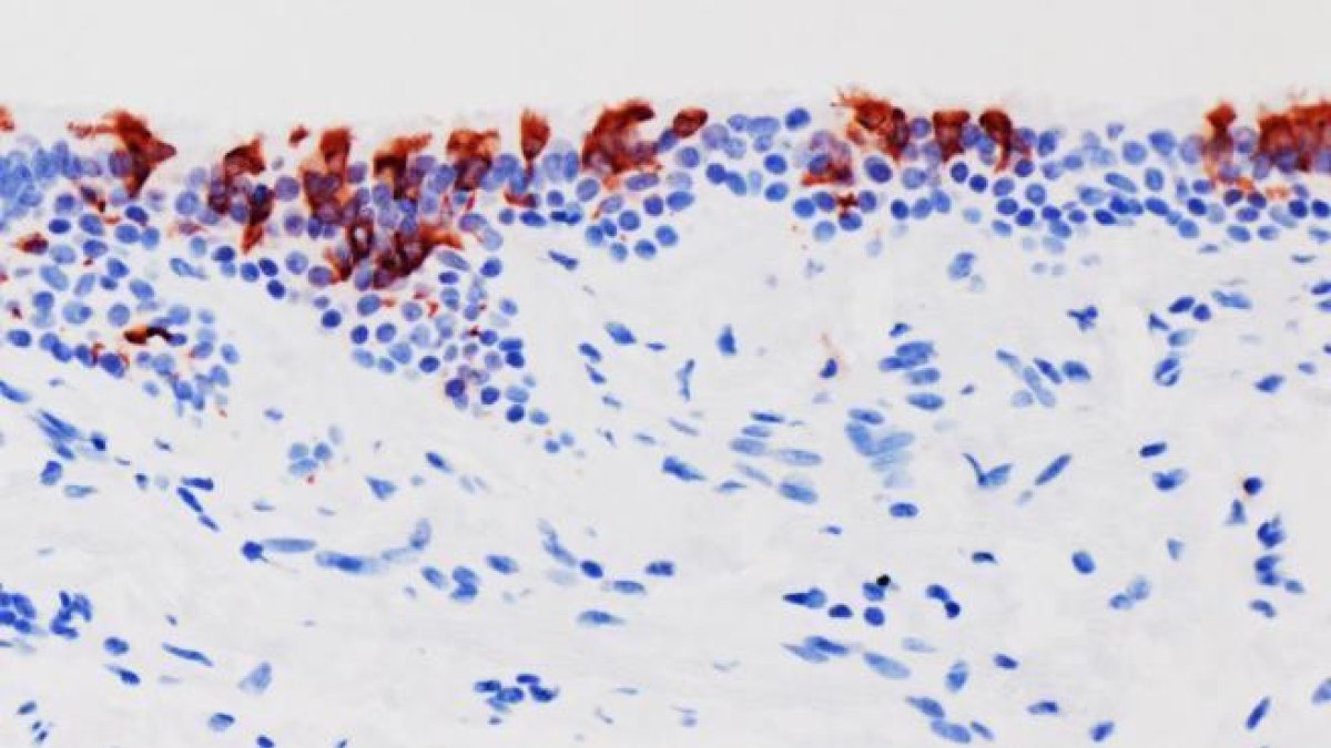 La variant ómicron del SARS-CoV-2 (en vermell) infectant teixits de bronquis humans.
