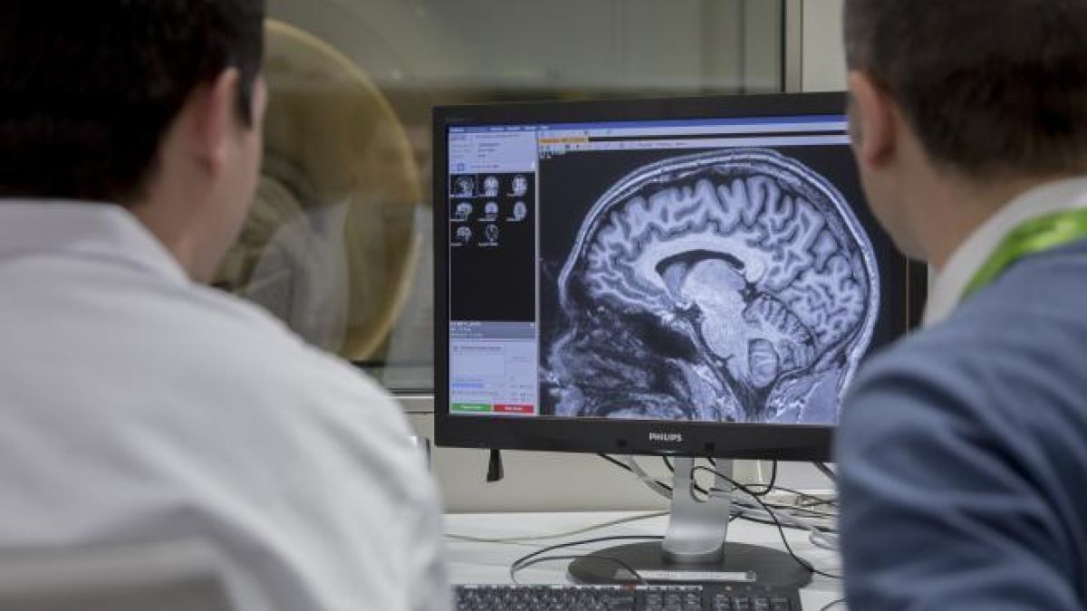 Imagen de dos especialistas analizando el cerebro de un paciente de Alzhéimer.