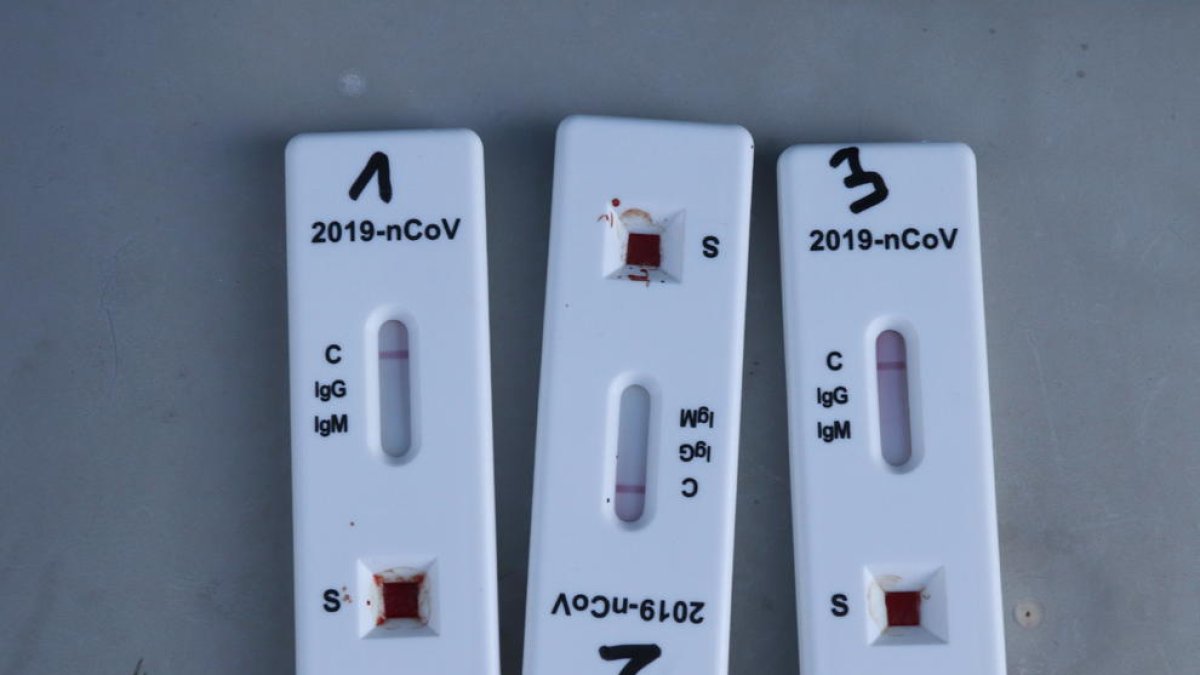 Imagen de tres tests de antígenos.