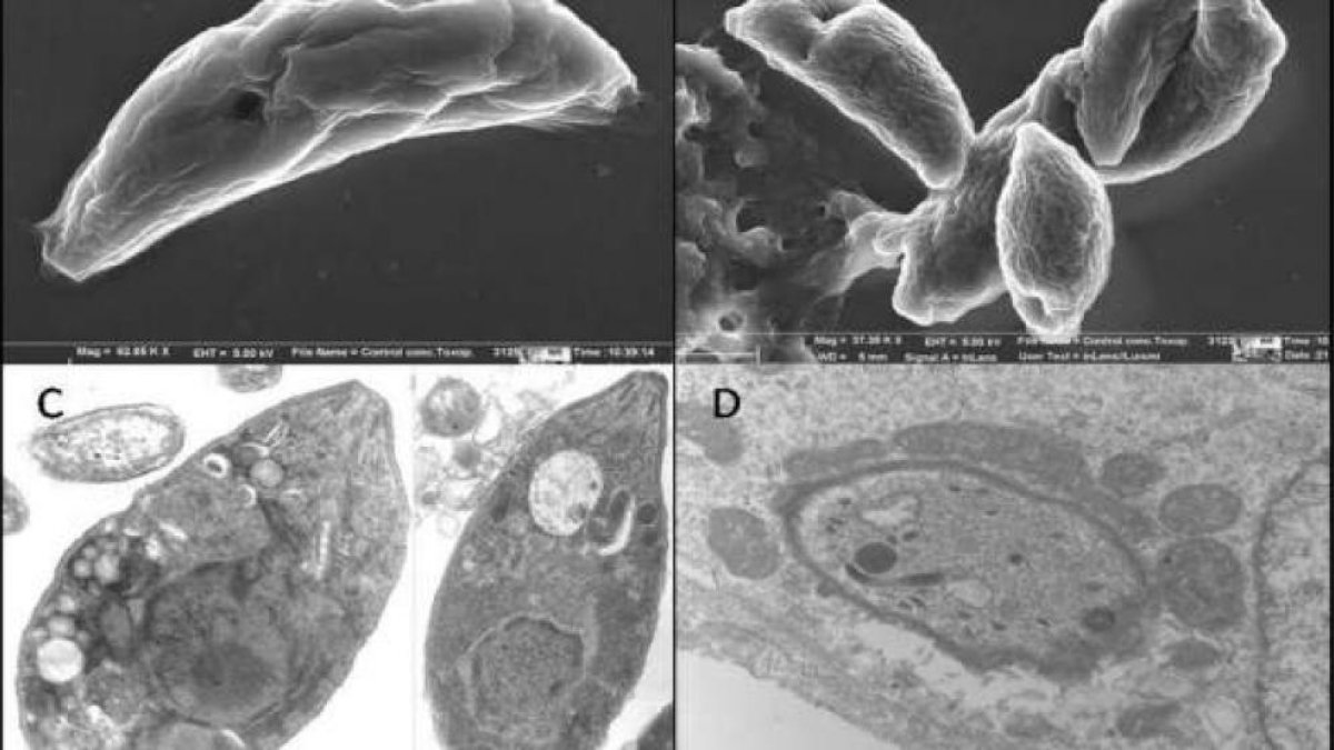 Imágenes de parásitos de Toxoplasma.