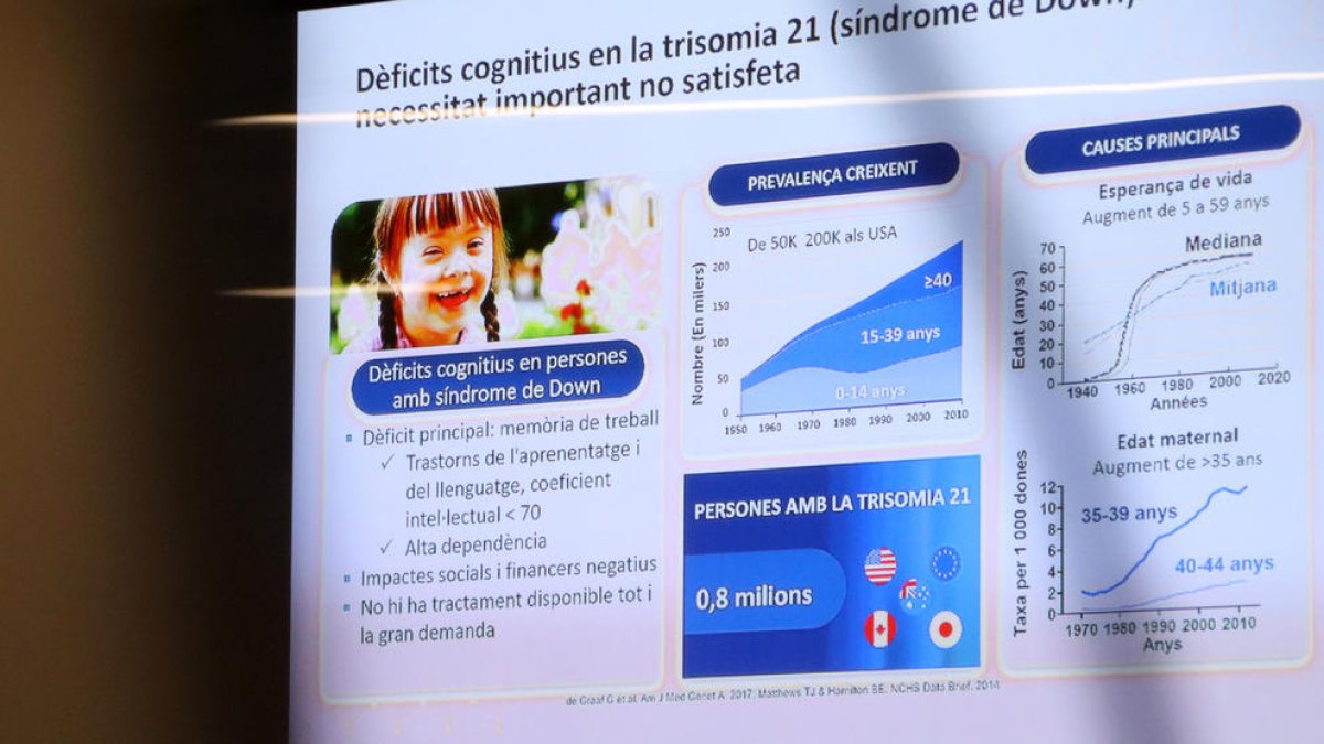 Explicació sobre el dèficit cognitiu de les persones amb síndrome de Down.