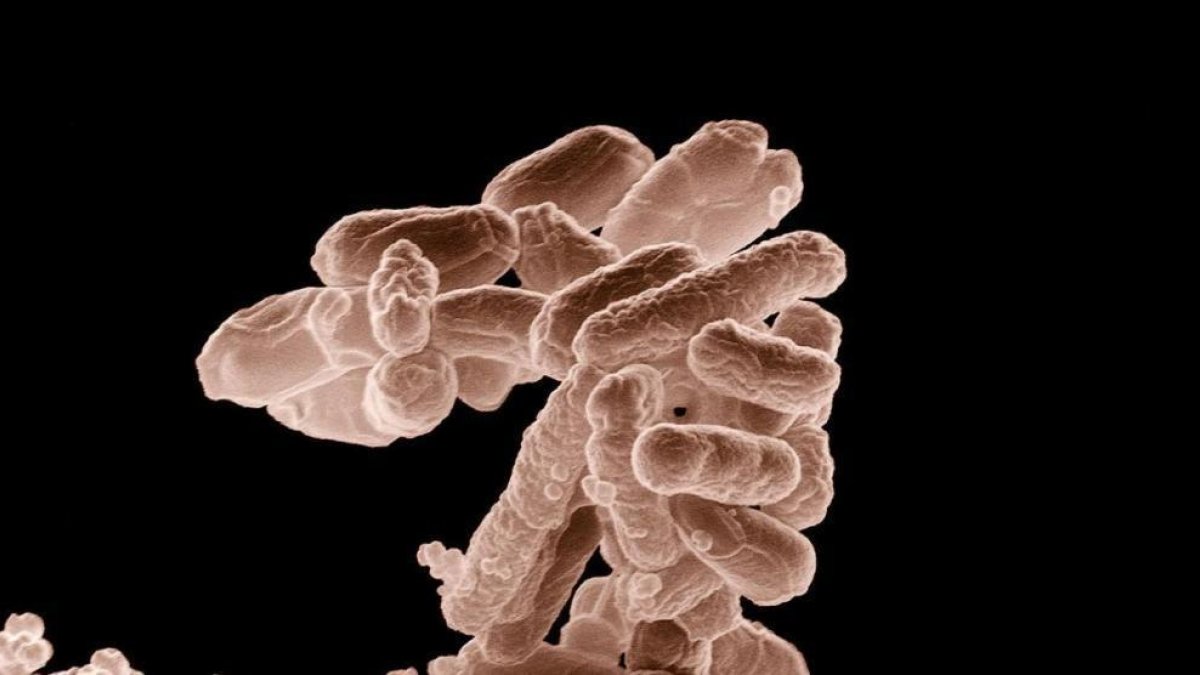 Bactèries E.Coli.