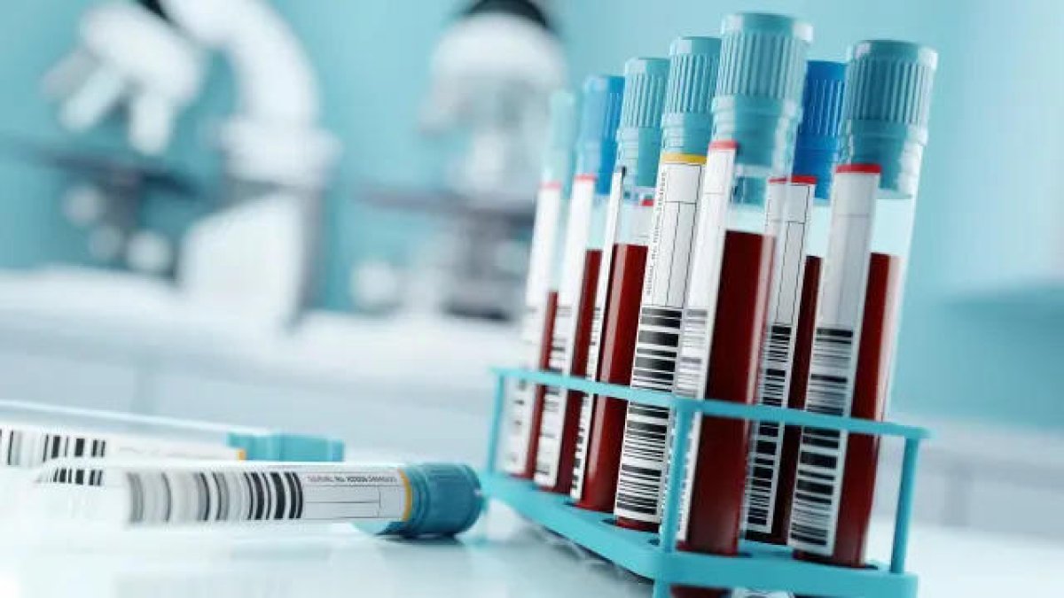 Els tests de biomarcadors poden beneficiar especialment pacients que no reporten els seus símptomes o el diagnòstic dels quals és incert.