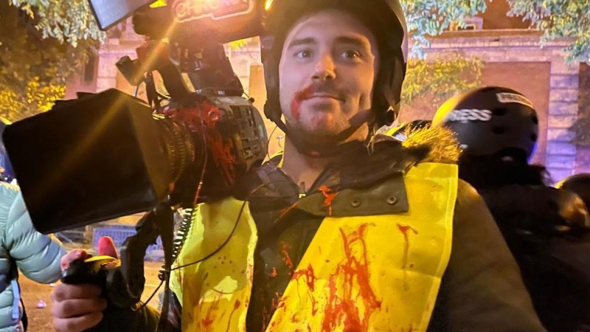 Periodista afectat per les agressions a les manifestacions de Ferraz.