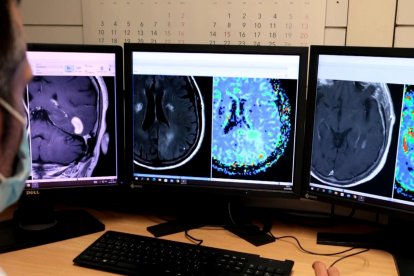 Un investigador mira ressonàncies magnètiques cerebrals en unes pantalles de l'Hospital de Bellvitge.