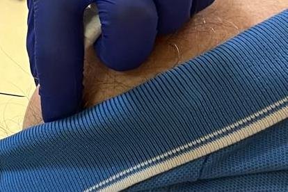 Una enfermera poniendo una vacuna.