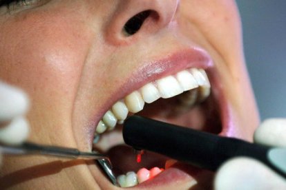 LEs investigacions més recents vinculen el bacteri de la gingivitis amb l'alzheimer.