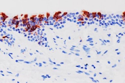 La variant ómicron del SARS-CoV-2 (en vermell) infectant teixits de bronquis humans.