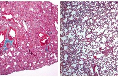 imatge a vista de microscopi de la molècula