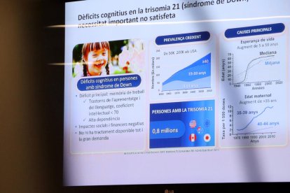 Explicació sobre el dèficit cognitiu de les persones amb síndrome de Down.