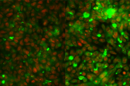 Imatge: comparació de cèl·lules de càncer colorectal abans (esquerra) i després (dreta) del tractament amb fluorouracil i irinotecan. L'expressió de les mucines es mostra en verd. Crèdit: Lluís Espinosa/IMIM.