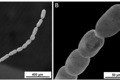 Descubren una bacteria gigante que es 5.000 veces mayor que la mayoría y se puede ver sin necesidad de microscopio