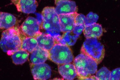 Crean nanocápsulas con control remoto para ampliar el efecto de las quimioterapias